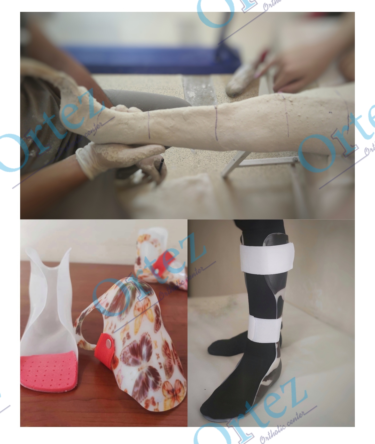 What is an orthosis